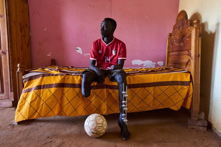 The scars of war among survivors in Sudan | iNFOnews.ca