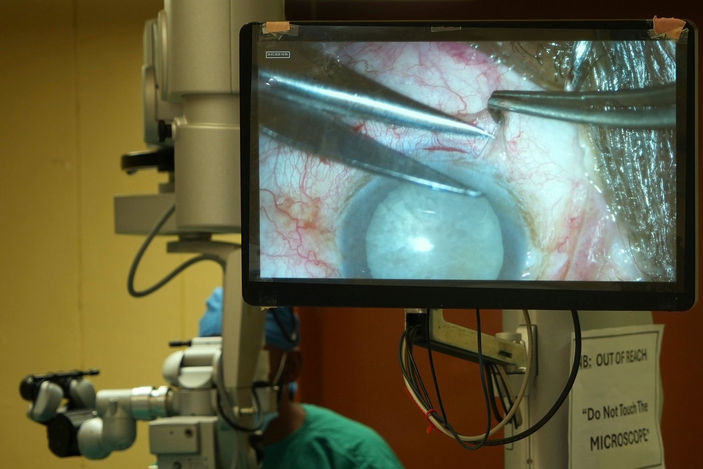'Wow!' The eye surgery marathon that restored sight for some South Africans | iNFOnews.ca