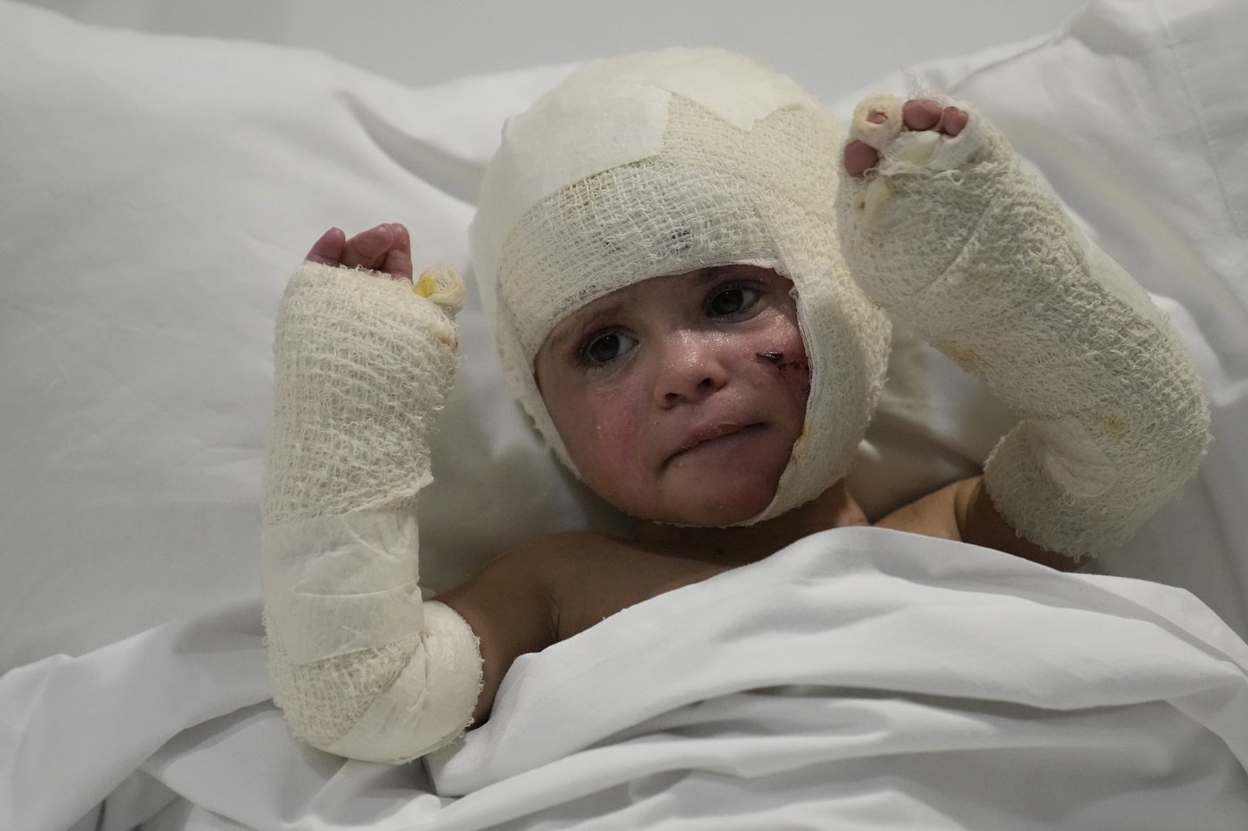 Traumatized by war, hundreds of Lebanon's children struggle with wounds both physical and emotional | iNFOnews.ca