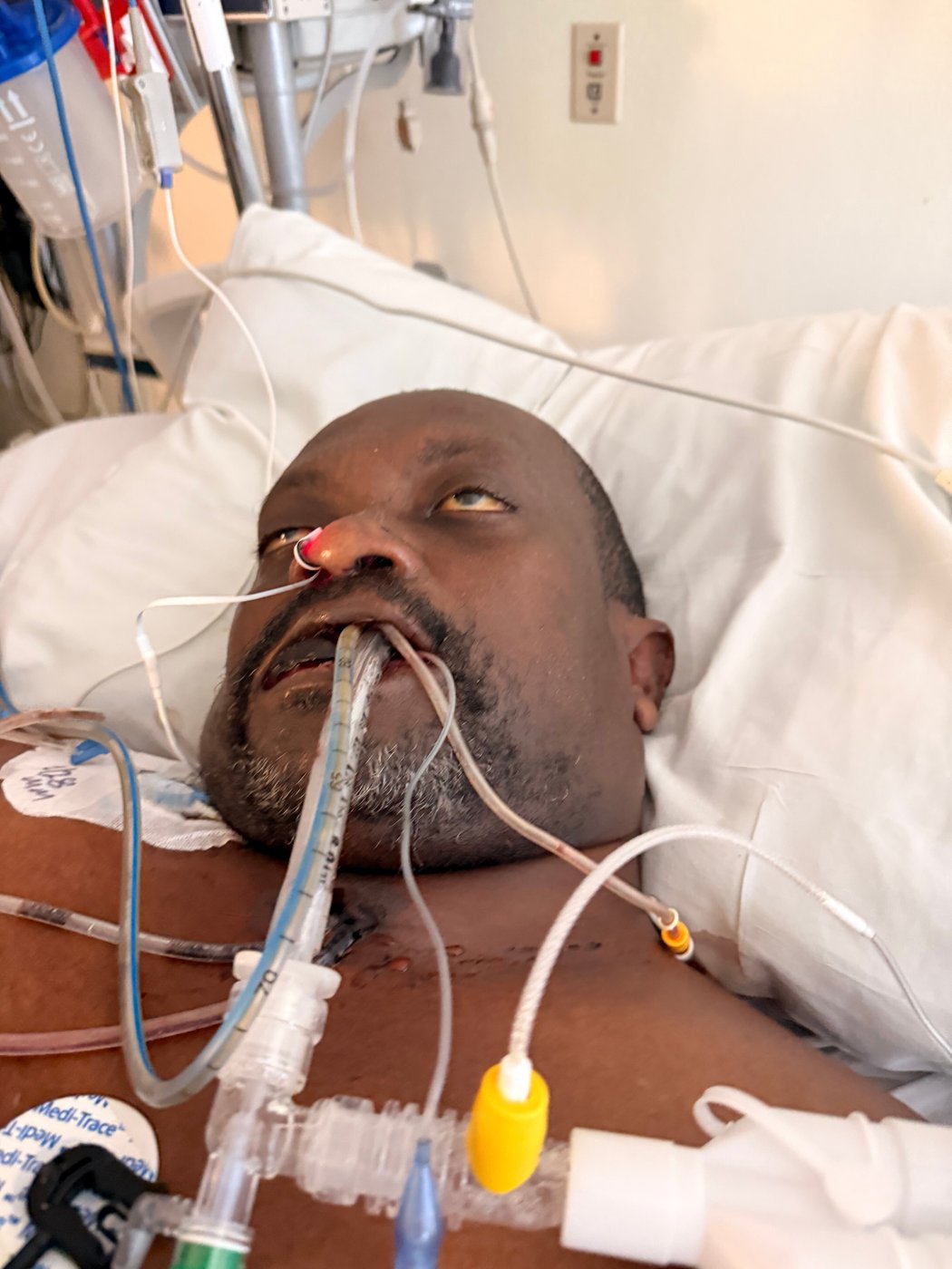 Haitian man dies in US immigration custody with untreated toothache, brother says | iNFOnews.ca