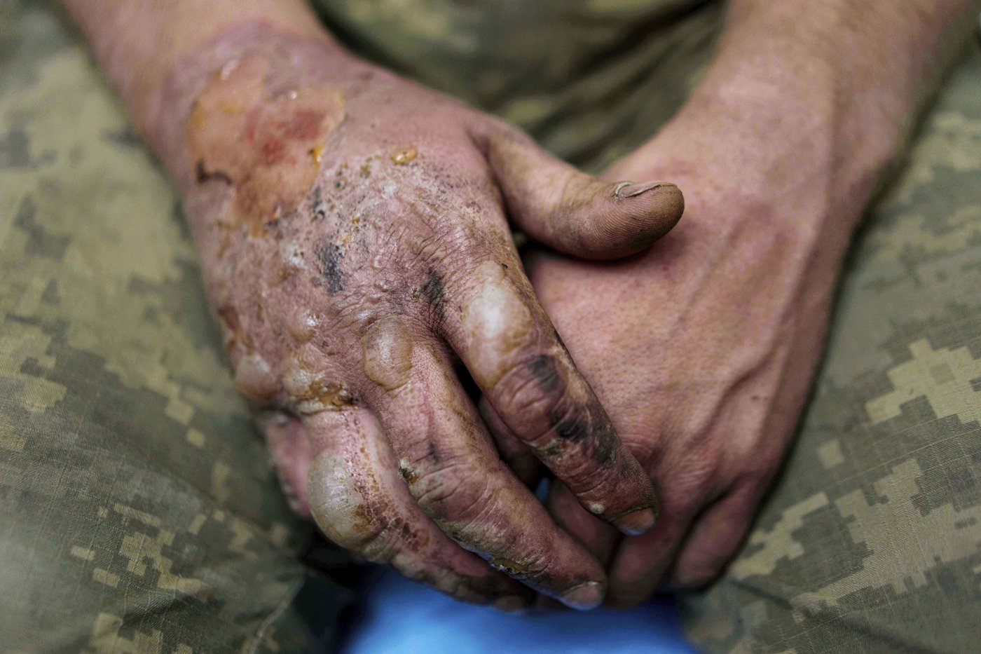 Ukrainian defenses face a challenge as Russian troops make gains ahead of the Putin-Trump summit | iNFOnews.ca