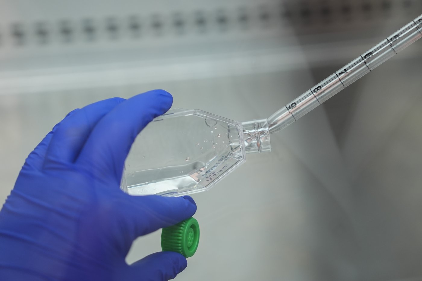 Researchers in a lab near Lake Erie study how toxic algae can damage health | iNFOnews.ca