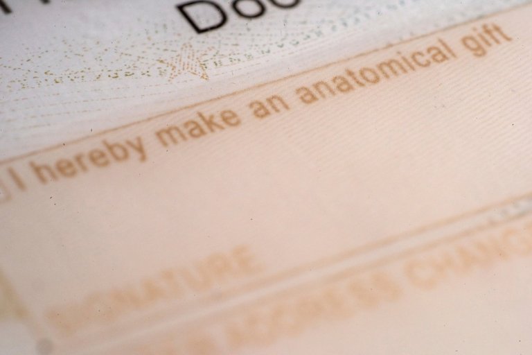 Public mistrust linked to drop in deceased donor organ donations and kidney transplants | iNFOnews.ca