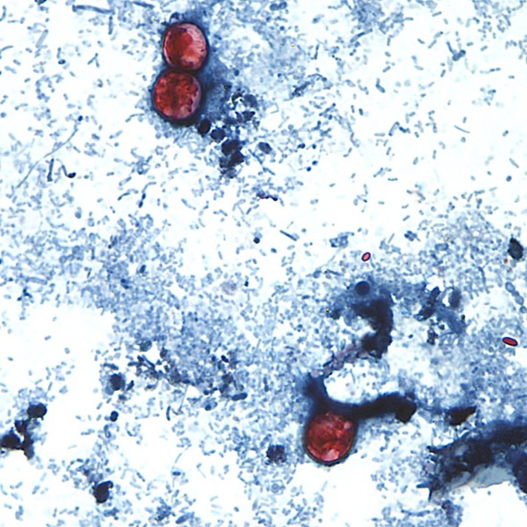 Diarrhea-causing parasite infecting more than 1,200 in Michigan has not spread to Canada: PHAC | iNFOnews.ca