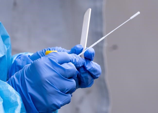 First antigen rapid test for COVID-19 gets Canadian approval | iNFOnews.ca