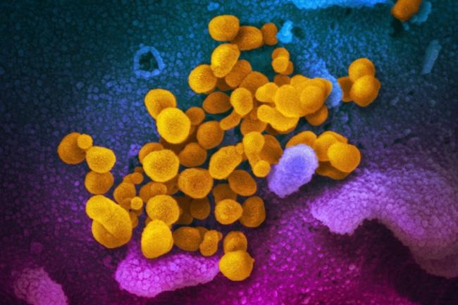 Canadian military dealing with surge in new COVID-19 infections since December | iNFOnews.ca CP1651714226