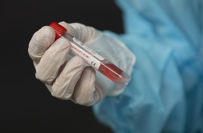 The latest numbers on COVID-19 in Canada for Friday, March 12, 2021 | iNFOnews.ca The latest numbers on COVID-19 in Canada for Friday, March 12, 2021 | iNFOnews.ca