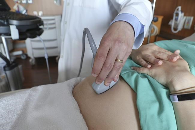 Study co-author says planned C-sections may be less risky for some moms and babies | iNFOnews.ca