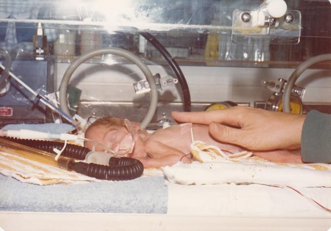 Boys born prematurely and very small age faster as men, study suggests | iNFOnews.ca