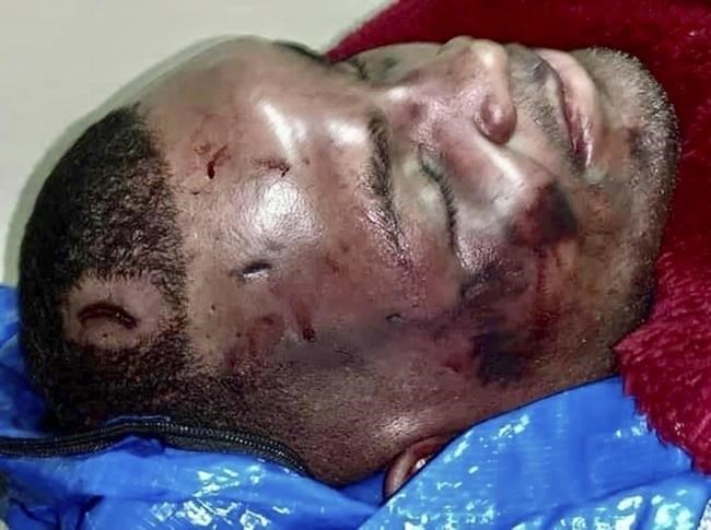 AP: Body cam prompts new look at what killed Black motorist | iNFOnews.ca