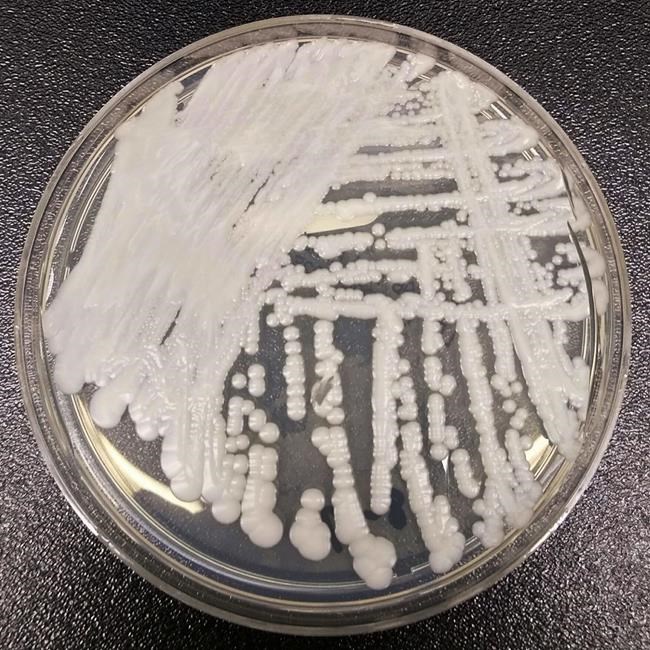 'Superbug' fungus spread in two cities, health officials say | iNFOnews.ca