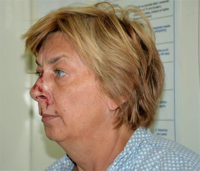 Croatian police identify woman found with memory loss | iNFOnews.ca Croatian police identify woman found with memory loss | iNFOnews.ca