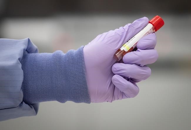 B.C. reports 667 cases of COVID-19, 13 deaths in wake of northern B.C. restrictions | iNFOnews.ca