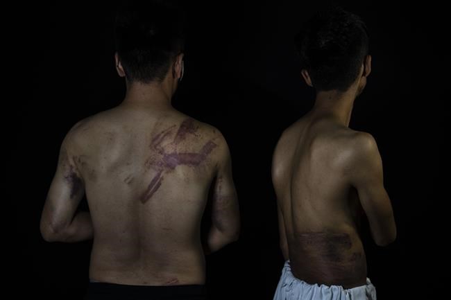 Watchdog: 30 recent cases of violence to Afghan journalists | iNFOnews.ca CP1543873539