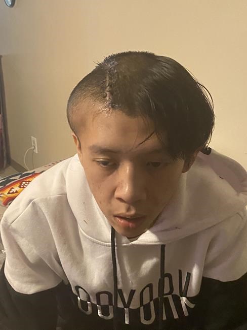 'Callous and inhumane': Lawsuit filed against Edmonton police for head injury | iNFOnews.ca 'Callous and inhumane': Lawsuit filed against Edmonton police for head injury | iNFOnews.ca