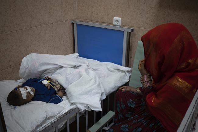 Emaciated children in Kabul hospital point to rising hunger | iNFOnews.ca Emaciated children in Kabul hospital point to rising hunger | iNFOnews.ca