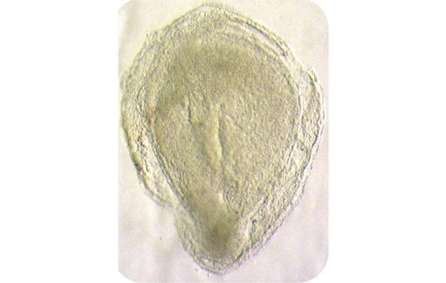 New research offers glimpse into early human development | iNFOnews.ca