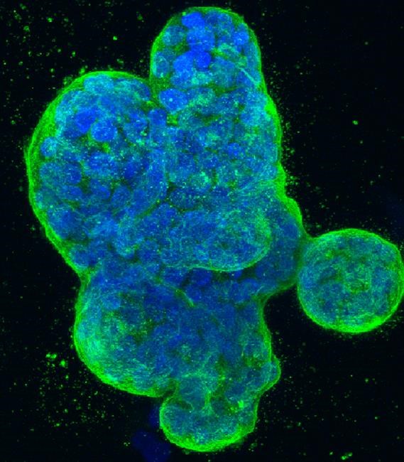 Study can't confirm lab results for many cancer experiments | iNFOnews.ca Study can't confirm lab results for many cancer experiments | iNFOnews.ca