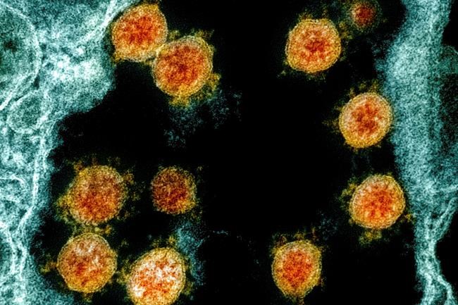 More federal prisons reporting COVID-19 outbreaks, dozens of new cases among staff | iNFOnews.ca