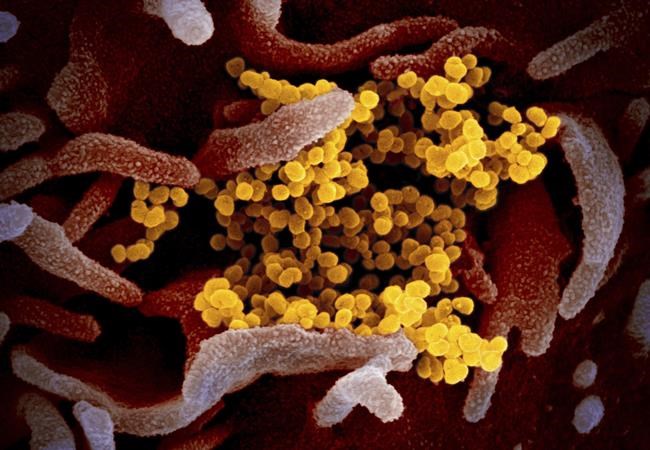Study finds that more serious COVID-19 infections led to more nightmares | iNFOnews.ca Study finds that more serious COVID-19 infections led to more nightmares | iNFOnews.ca