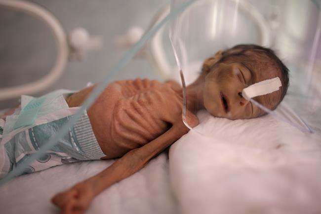 UN food agency says 13 million Yemenis may face starvation | iNFOnews.ca CP1727141279