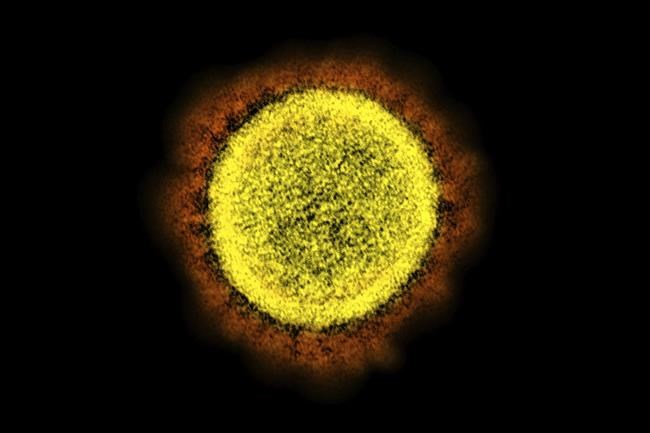 As 'stealth omicron' advances, scientists are learning more | iNFOnews.ca As 'stealth omicron' advances, scientists are learning more | iNFOnews.ca