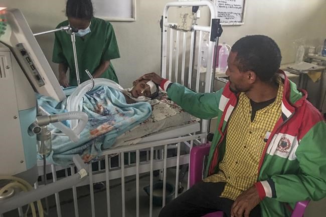 Hospital in Ethiopia's Tigray struggles to treat patients | iNFOnews.ca CP2018554224