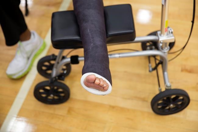 Heal Thyself: Most who tear Achilles tendon can skip surgery | iNFOnews.ca