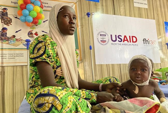 Child malnutrition mounts amid conflict in northeast Nigeria | iNFOnews.ca CP1143710443