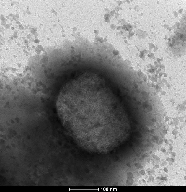 Spanish LGBTQ groups wary of monkeypox stigma as Pride nears | iNFOnews.ca Spanish LGBTQ groups wary of monkeypox stigma as Pride nears | iNFOnews.ca
