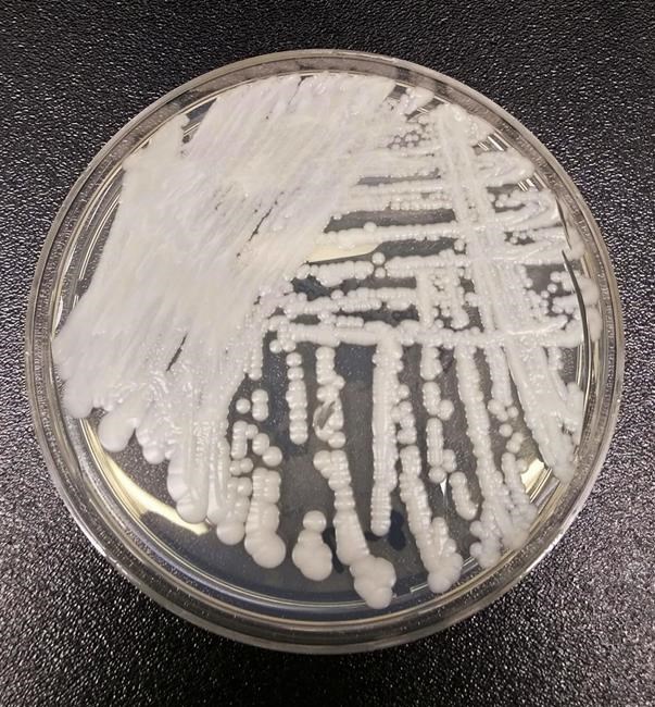 Superbug fungus cases rose dramatically during pandemic | iNFOnews.ca