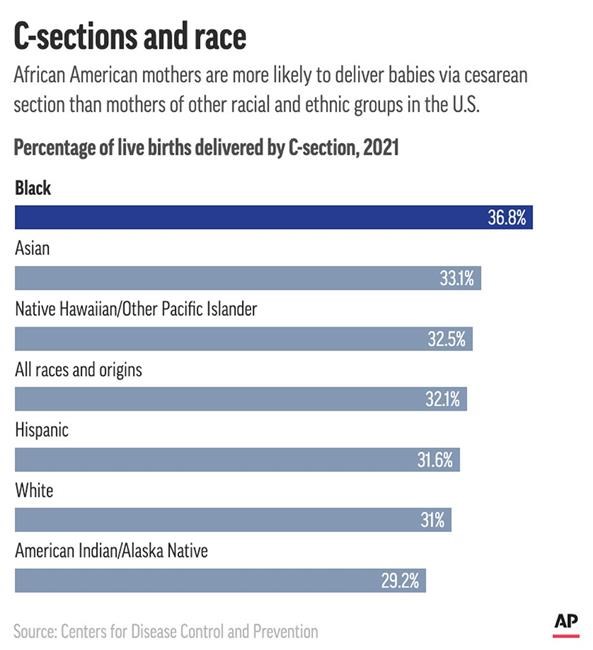 Why do so many Black women die in pregnancy? One reason: Doctors don't take them seriously | iNFOnews.ca