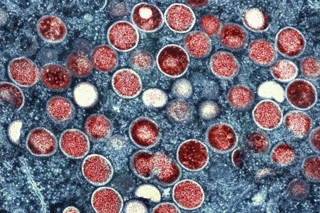 Mpox is down, but US cities could be at risk for summertime outbreaks | iNFOnews.ca