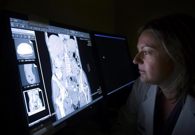 Groups want timely, accessible data on cancer to help improve outcomes | iNFOnews.ca