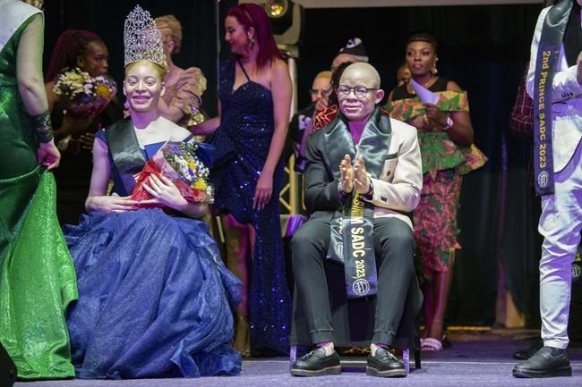 Winner of albinism pageant says Zimbabwe event made her feel beautiful and provided sense of purpose | iNFOnews.ca Winner of albinism pageant says Zimbabwe event made her feel beautiful and provided sense of purpose | iNFOnews.ca