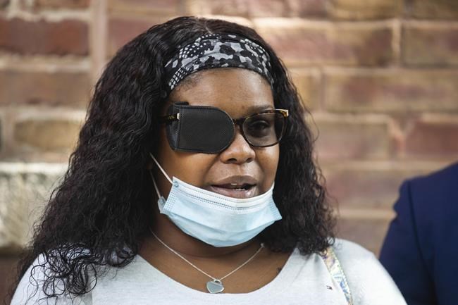 Police board votes to fire Chicago officer accused of dragging woman by the hair during 2020 unrest | iNFOnews.ca