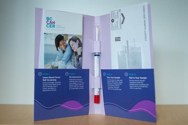 Cancer society, gynecologists hope for national shift in cervical cancer screening | iNFOnews.ca