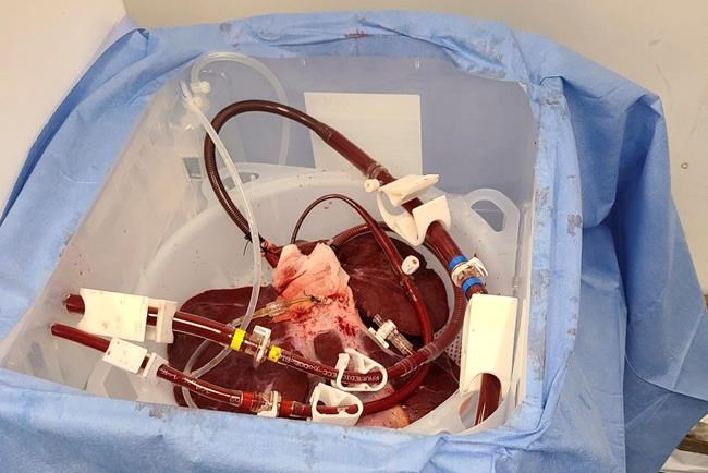 A first-ever experiment shows how pigs might one day help people who have liver failure | iNFOnews.ca A first-ever experiment shows how pigs might one day help people who have liver failure | iNFOnews.ca