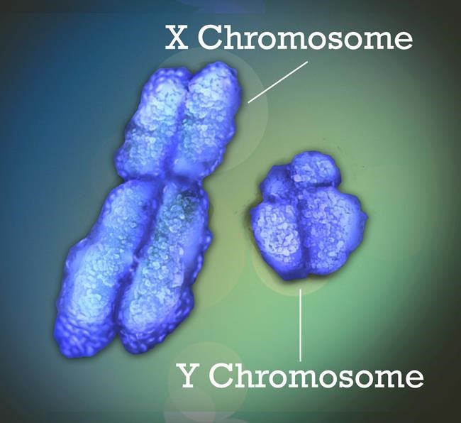 Lupus and other autoimmune diseases strike far more women than men. Now there's a clue why | iNFOnews.ca