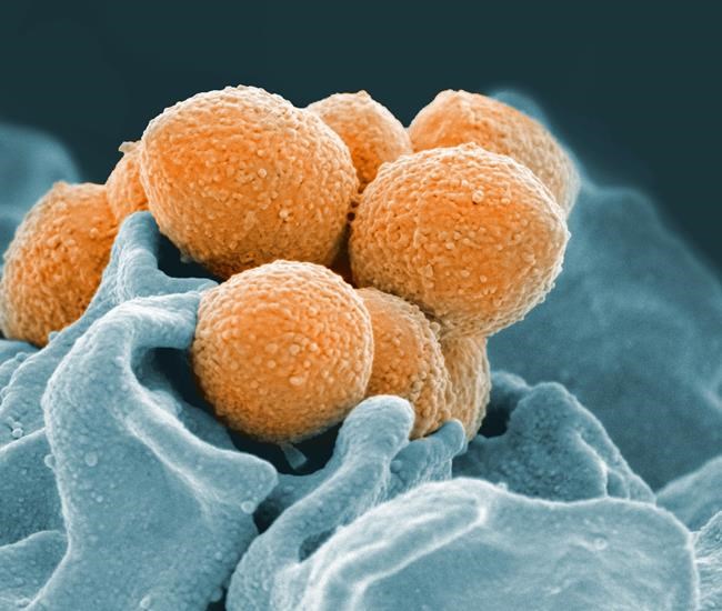 What is the 'flesh-eating' infection that recently claimed leg of B.C. firefighter? | iNFOnews.ca