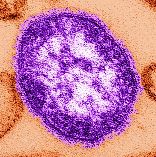 West Virginia confirms first measles case since 2009 | iNFOnews.ca West Virginia confirms first measles case since 2009 | iNFOnews.ca