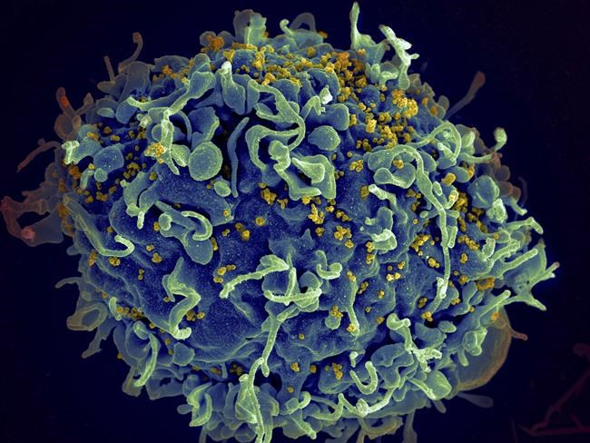 CDC says it's identified 1st documented cases of HIV transmitted through cosmetic needles | iNFOnews.ca CDC says it's identified 1st documented cases of HIV transmitted through cosmetic needles | iNFOnews.ca