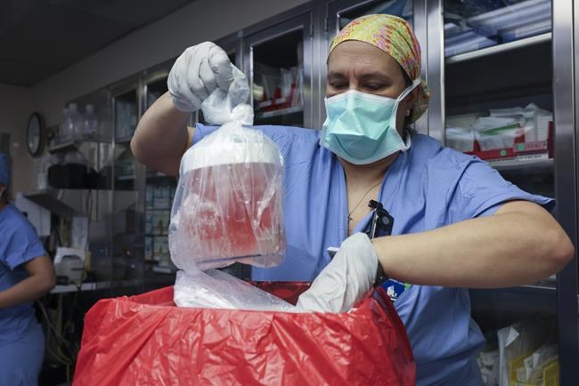 First person to receive a genetically modified pig kidney transplant dies nearly 2 months later | iNFOnews.ca First person to receive a genetically modified pig kidney transplant dies nearly 2 months later | iNFOnews.ca