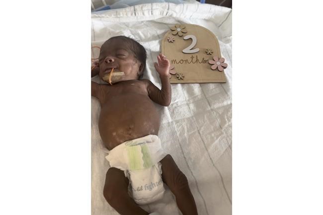 `Micropreemie' baby who weighed just over 1 pound at birth goes home from Illinois hospital | iNFOnews.ca