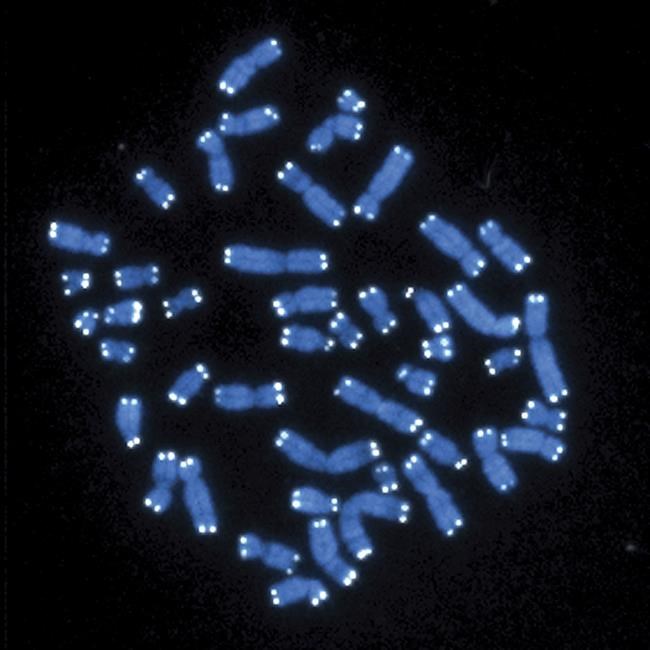 Researchers find a single, surprising gene behind a disorder that causes intellectual disability | iNFOnews.ca