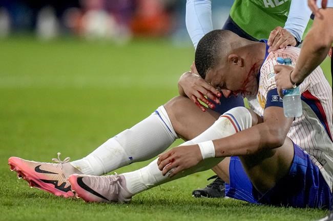 Kylian Mbappé due for tests on his broken nose as France gets 'positive' news on the striker | iNFOnews.ca Kylian Mbappé due for tests on his broken nose as France gets 'positive' news on the striker | iNFOnews.ca