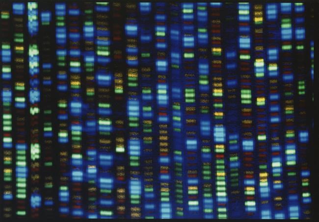 Takeaways from AP's report on access to gene therapies for rare diseases | iNFOnews.ca