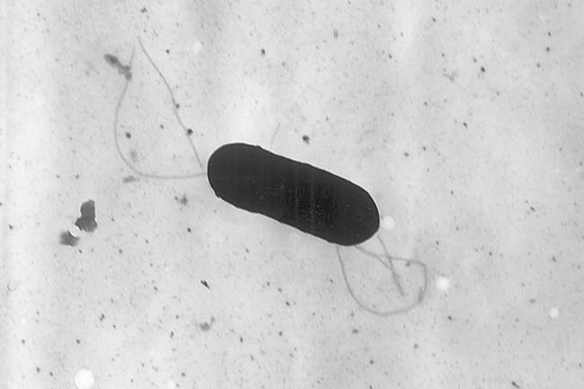What is listeriosis, the illness recently linked to a recall of plant-based milks? | iNFOnews.ca