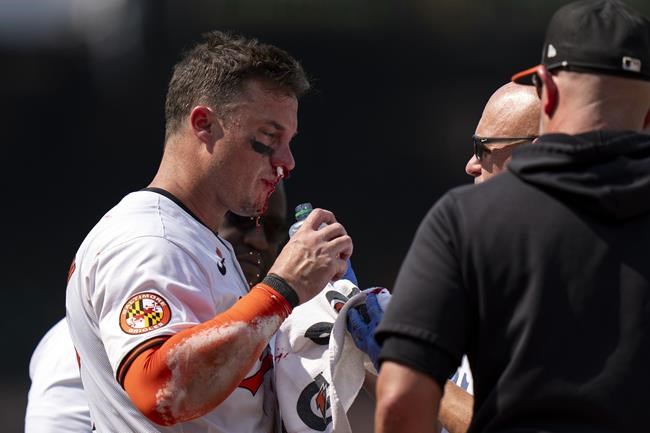 Orioles catcher McCann shrugs off fastball to face, stays in game against Jays | iNFOnews.ca