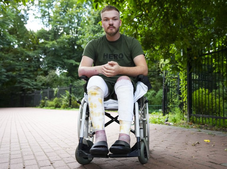 'Nothing's changing': Calgary man recovering in Ukraine sees no end to war | iNFOnews.ca